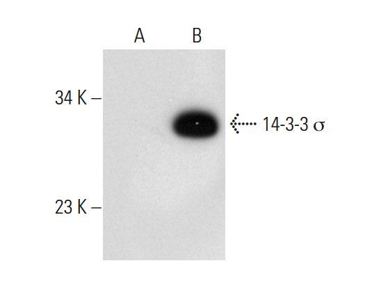 14-3-3 σ (E-11): sc-166473. Western blot analysis of 14-3-3 σ expression in non-transfected 293T: sc-117752 (A), human 14-3-3 σ transfected 293T: sc-110782 (B) and A-431 (C) whole cell lysates.