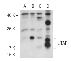 LITAF (FL-161): sc-66945. Western blot analysis of LITAF expression in non-transfected 293T: sc-117752 (A), human LITAF transfected 293T: sc-111383 (B) and HL-60 (C) whole cell lysates and mouse brain tissue extract (D).