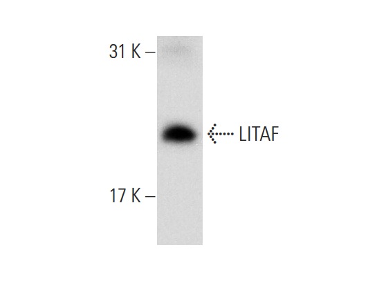 LITAF (FL-161): sc-66945. Western blot analysis of LITAF expression in RAW 264.7 whole cell lysate.