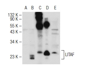 LITAF (FL-161): sc-66945. Western blot analysis of LITAF expression in non-transfected 293T: sc-117752 (A), mouse LITAF transfected 293T: sc-110364 (B), human PBL (C), rat PBL (D) and A-431 (E) whole cell lysates.