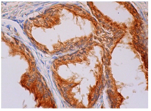 LITAF (FL-161): sc-66945. Immunoperoxidase staining of formalin fixed, paraffin-embedded human prostate tissue showing cytoplasmic staining of glandular cells.