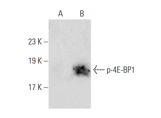 p-4E-BP1/2/3 (Thr 45)-R: sc-18090-R. Western blot analysis of 4E-BP1 phosphorylation in non-transfected: sc-117752 (A) and untreated human 4E-BP1 transfected: sc-116590 (B) 293T whole cell lysates.