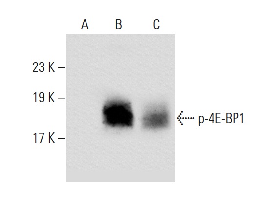 p-4E-BP1/2/3 (Thr 45)-R: sc-18090-R. Western blot analysis of 4E-BP1 phosphorylation in non-transfected: sc-117752 (A), untreated human 4E-BP1 transfected: sc-116590 (B) and lambda protein phosphatase treated human 4E-BP1 transfected: sc-116590 (C) 293T whole cell lysates.