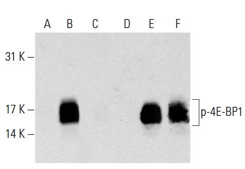 Western blot analysis of 4E-BP1 phosphorylation in non-transfected: sc-117752 (A,D), untreated human 4E-BP1 transfected: sc-116590 (B,E) and lambda protein phosphatase (sc-200312A) treated human 4E-BP1 transfected: sc-116590 (C,F) 293T whole cell lysates. Antibodies tested include p-4E-BP1/2/3 (Thr 45)-R: sc-18090-R (A,B,C) and 4E-BP1 (11G12C11): sc-81149 (D,E,F).