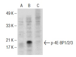 Western blot analysis of 4E-BP1/2/3 phosphorylation in untreated (A), calyculin A treated (B) and calyculin A and lambda protein phosphatase (sc-200312A) treated (C) Jurkat whole cell lysates. Antibodies tested include p-4E-BP1/2/3 (Thr 45)-R: sc-18090-R (A,B,C).