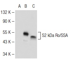 52 kDa Ro/SSA (H-140): sc-20960. Western blot analysis of 52 kDa Ro/SSA expression in non-transfected 293T: sc-117752 (A), human 52 kDa Ro/SSA transfected 293T: sc-158201 (B) and HT-1080 (C) whole cell lysates.