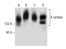 A cyclase (C-5): sc-377243. Western blot analysis of A cyclase expression in rat heart (A), human heart (B) and human ovary (C) tissue extracts and IMR-32 (D) whole cell lysate.