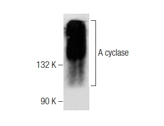 A cyclase (C-5): sc-377243. Western blot analysis of A cyclase expression in mouse brain tissue extract.