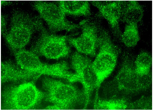 A cyclase (C-5): sc-377243. Immunofluorescence staining of methanol-fixed HeLa cells showing cytoplasmic localization.