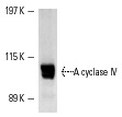 A cyclase (R-32): sc-1701. Western blot analysis of insect cells transfected with an A cyclase IV baculovirus expression vector.