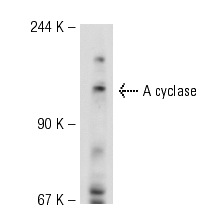 A cyclase (R-32): sc-1701. Western blot analysis of A cyclase expression in SH-SY5Y whole cell lysate.