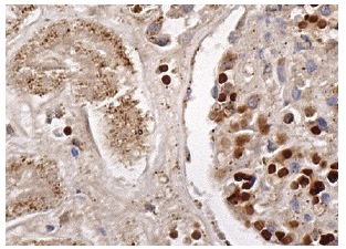 A cyclase (R-32): sc-1701. Immunoperoxidase staining of formalin fixed, paraffin-embedded human kidney tissue showing cytoplasmic and nuclear staining of cells in glomeruli and tubules.