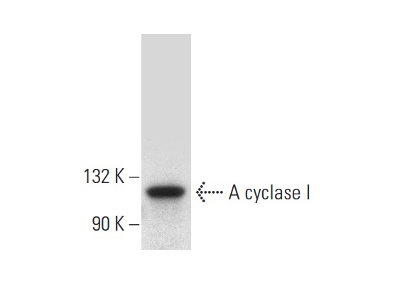 A cyclase I (F-10): sc-365350. Western blot analysis of A cyclase I expression in ARPE-19 whole cell lysate.