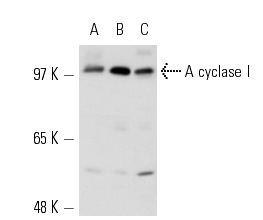 A cyclase I (V-20): sc-586. Western blot analysis of A cyclase I expression in Y79 (A), ARPE-19 (B) and IMR-32 (C) whole cell lysates.