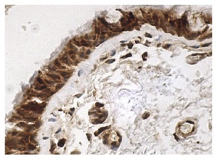 A cyclase I (H-70): sc-25743. Immunoperoxidase staining of formalin fixed, paraffin-embedded human bronchus tissue showing nuclear and cytoplasmic staining of respiratory epithelial cells.