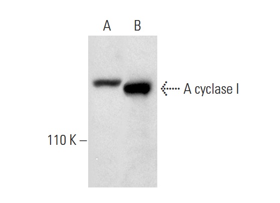 A cyclase I (H-70): sc-25743. Western blot analysis of A cyclase I expression in IMR-32 whole cell lysate (A) and rat brain tissue extract (B).