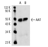 AAT (G-17): sc-14586. Western blot analysis of AAT expression in rat liver (A) and mouse lung (B) tissue extracts.