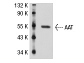 AAT (G-17): sc-14586. Western blot analysis of AAT expression in rat liver tissue extract.
