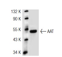 AAT (G-17): sc-14586. Western blot analysis of AAT expression in mouse lung tissue extract.