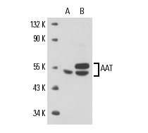 AAT (48D2): sc-69752. Western blot analysis of AAT expression in Hep G2 whole cell lysate (A) and human liver tissue extract (B).