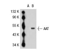 AAT (48D2): sc-69752. Western blot analysis of AAT expression in non-transfected: sc-117752 (A) and human AAT transfected: sc-112989 (B) 293 whole cell lysates.