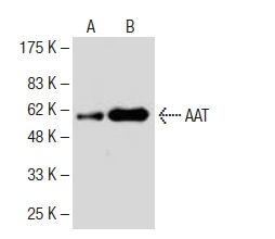 AAT (48D2): sc-69752. Western blot analysis of AAT purified from human plasma (A) and in human plasma (B).