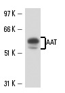 AAT (702): sc-66025. Western blot analysis of AAT expression in human liver tissue extract.
