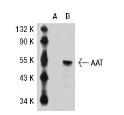 AAT (702): sc-66025. Western blot analysis of AAT expression in non-transfected: sc-117752 (A) and human AAT transfected: sc-112989 (B) 293T whole cell lysates.