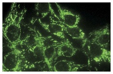ADX Reductase (H-300): sc-25846. Immunofluorescence staining of methanol-fixed Hep G2 cells showing cytoplasmic localization.