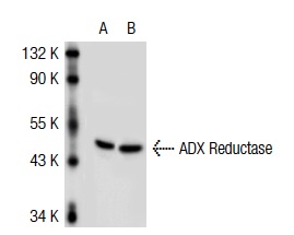 ADX Reductase (H-300): sc-25846. Western blot analysis of ADX Reductase expression in non-transfected: sc-117752 (A) and human ADX Reductase transfected: sc-116863 (B) 293T whole cell lysates.