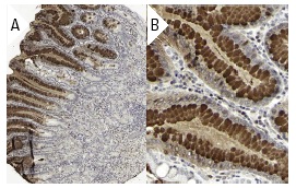 ACLP/AEBP1 (H-164): sc-32919. Immunoperoxidase staining of formalin fixed, paraffin-embedded human stomach tissue showing cytoplasmic staining of glandular cells at low (A) and high (B) magnification. Kindly provided by The Swedish Human Protein Atlas (HPA) program.