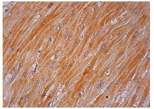 ACLP/AEBP1 (H-164): sc-32919. Immunoperoxidase staining of formalin fixed, paraffin-embedded human smooth muscle tissue showing cytoplasmic staining of smooth muscle cells.