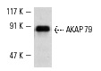 AKAP 79 (D-9): sc-17772. Western blot analysis of AKAP 79 expression in IMR-32 whole cell lysate.