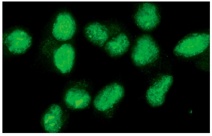 AKAP 95 (R-20): sc-6447. Immunofluorescence staining of methanol-fixed 3611-RF cells showing nuclear localization.
