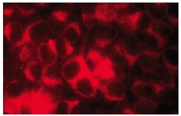 αA-crystallin (B-2): sc-28306. Immunofluorescence staining of methanol-fixed y79 cells showing cytoplasmic localization.