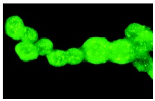αB-crystallin (FL-175): sc-22744. Immunofluorescence staining of methanol-fixed Y79 cells showing cytoplasmic localization.