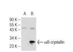 αB-crystallin (FL-175): sc-22744. Western blot analysis of αB-crystallin expression in non-transfected: sc-110760 (A) and human αB-crystallin transfected: sc-127880 (B) 293 whole cell lysates.