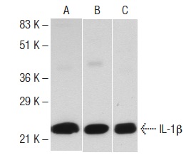 Western blot analysis of human recombinant IL-1β (A) and mouse recombinant IL-1β (B,C). Antibodies tested include IL-1β (C-20): sc-1250 (A), IL-1β (M-20): sc-1251 (B) and IL-1β (R-20): sc-1252 (C).