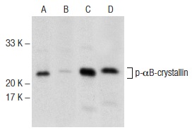Western blot analysis of αB-crystallin phosphorylation in untreated (A,C) and lambda protein phosphatase (sc-200312A) treated (B,D) rat heart tissue extracts. Antibodies tested include p-αB-crystallin (F-1): sc-365884 (A,B) and αB-crystallin (F-10): sc-137129 (C,D).