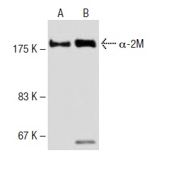 Immunoprecipitation of α-2M from human plasma (B) using α-2M (3D1)): sc-81540 (mouse monoclonal antibody) followed by Western blot analysis using α-2M (2D9): sc-69750 (mouse monoclonal antibody) as compared with human plasm (A).