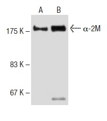 Immunoprecipitation of α-2M from human plasma (B) using α-2M (9A3): sc-81541 (mouse monoclonal antibody) followed by Western blot analysis using α-2M (2D9): sc-69750 (mouse monoclonal antibody) as compared with human plasma (A).
