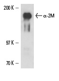α-2M (2D9): sc-69750. Western blot analysis of human recombinant α-2 macroglobulin.