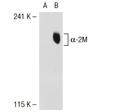 α-2M (2D9): sc-69750. Western blot analysis of α-2M expression in non-transfected: sc-117752 (A) and human α-2M transfected: sc-115474 (B) 293T whole cell lysates.