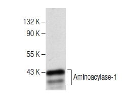 Aminoacylase-1 (B-1): sc-271019. Western blot analysis of Aminoacylase-1 expression in HeLa whole cell lysate.