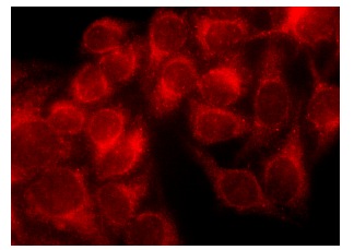 Aminoacylase-1 (L-19): sc-55060. Immunofluorescence staining of methanol-fixed HeLa cells showing cytoplasmic localization.