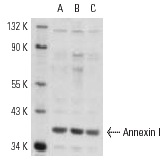 Annexin I (H-65): sc-11387. Western blot analysis of Annexin I expression in A-431 (A), K-562 (B) and Caki-1 (C) whole cell lysates.