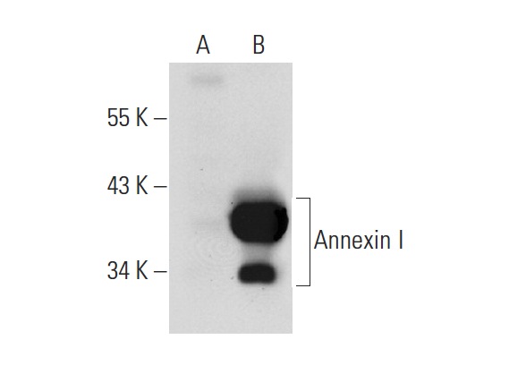 Annexin I (H-65): sc-11387. Western blot analysis of Annexin I expression in non-transfected: sc-117752 (A) and mouse Annexin I transfected: sc-118428 (B) 293T whole cell lysates.