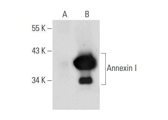 Annexin I (H-65): sc-11387. Western blot analysis of Annexin I expression in non-transfected: sc-117752 (A) and mouse Annexin I transfected: sc-118429 (B) 293T whole cell lysates.
