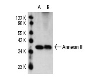 Annexin II (3D5): sc-47696. Western blot analysis of Annexin II expression in non-transfected: sc-110760 (A) and human Annexin II transfected: sc-111344 (B) 293 whole cell lysates.