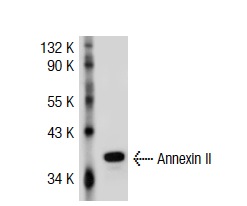 Annexin II (3D5): sc-47696. Western blot analysis of Annexin II expression in HeLa whole cell lysate.